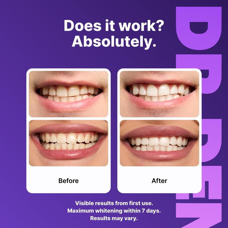 Purple Whitening Strips