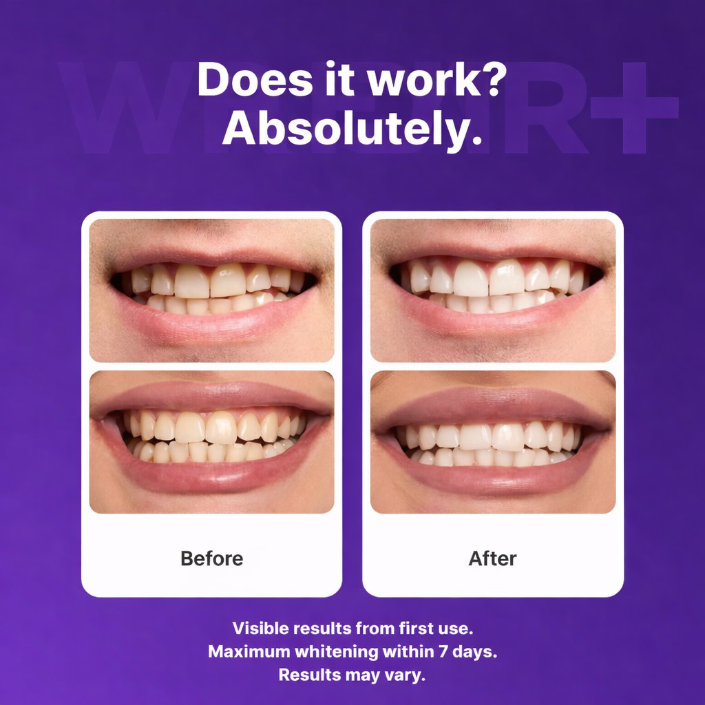 Purple Whitening Strips